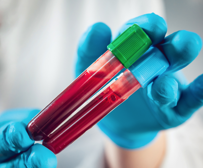 τεστ-αίματος-προβλέπει-την-πρόγνωση-τ-368239