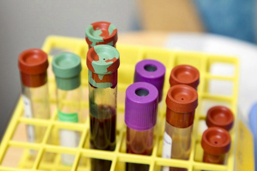 το-πλάσμα-του-αίματος-ιαθέντων-ασθενώ-576015