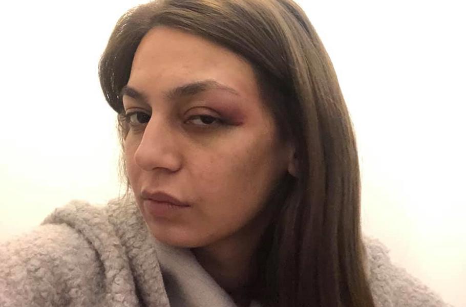 απατζίδη ξυλοδαρμός