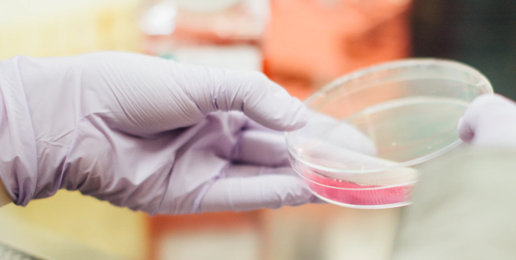 επιθετικός-καρκίνος-μαστού-σε-άνδρες-901135