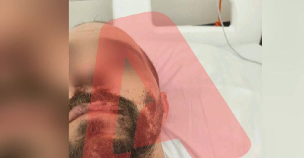 ηράκλειο-17χρονος-οδηγός-παρέσυρε-και-ε-1344254