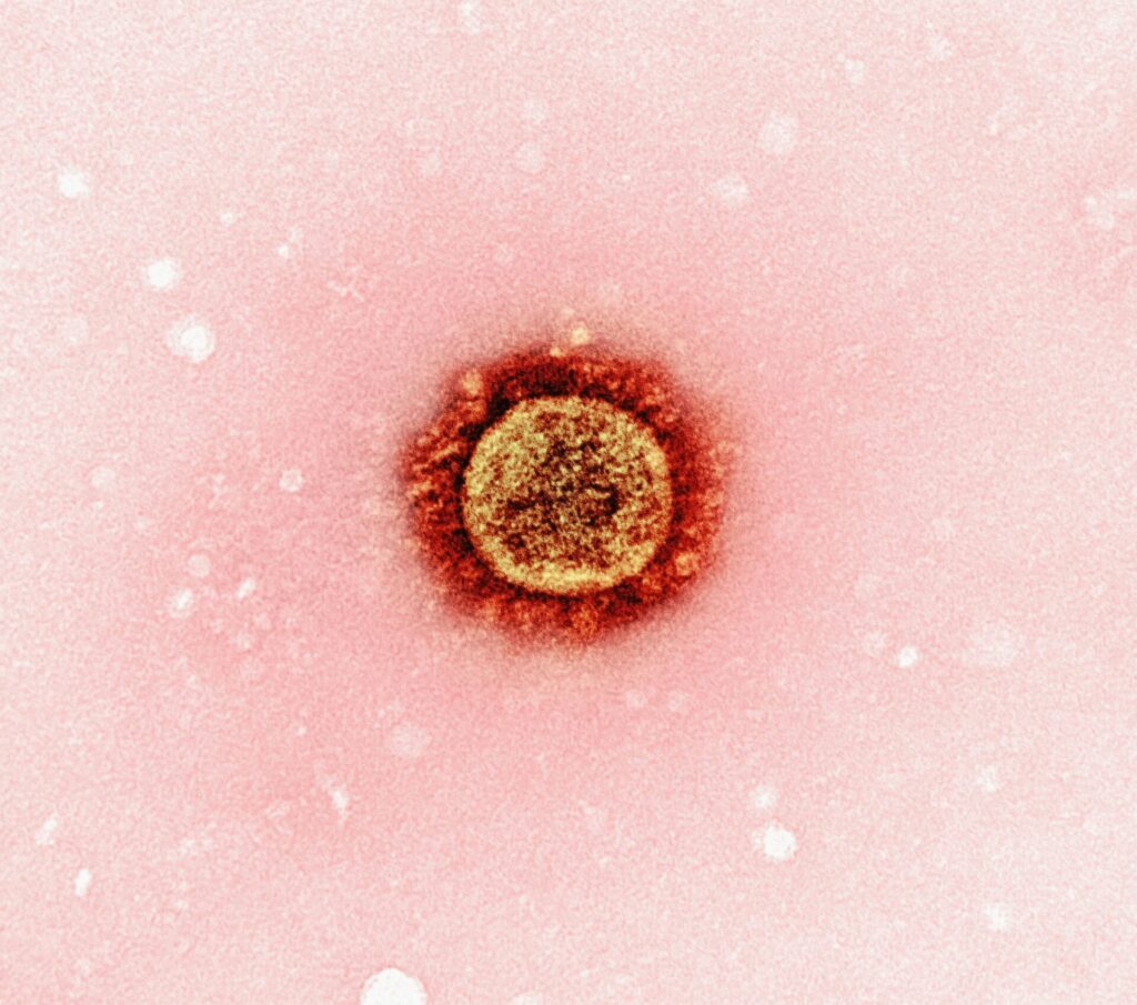 έρπης-ζωστήρας-πώς-μεταδίδεται-και-πο-1421941