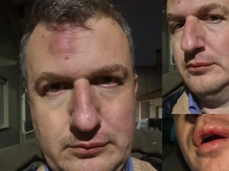 άγρια-επίθεση-σε-εκδότη-τοπικής-εφημε-1427647