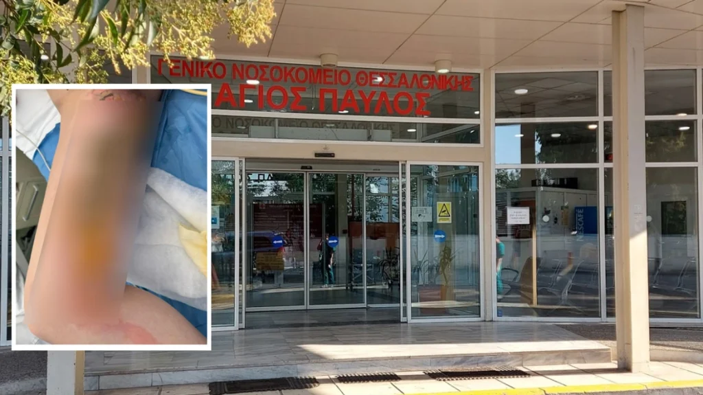 θεσσαλονίκη-20χρονη-μπήκε-στο-νοσοκομε-1492067