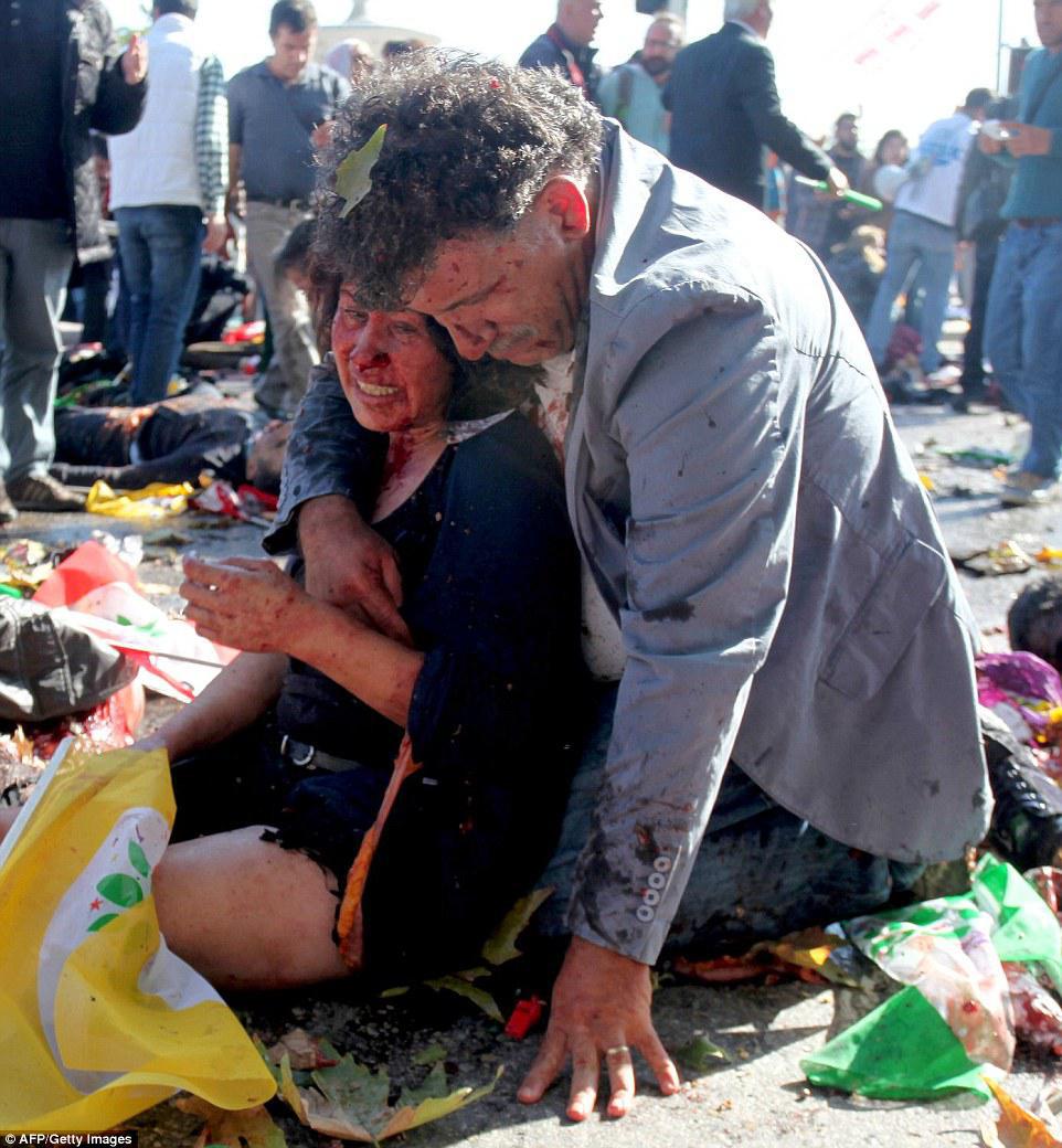 Τραυματισμένη γυναίκα υποβαστάζεται από τον άντρα της, λίγα λεπτά μετά από την διπλή επίθεσης αυτοκτονίας με έκρηξη βόμβας σε σταθμό του μετρό στην Άγκυρα. 