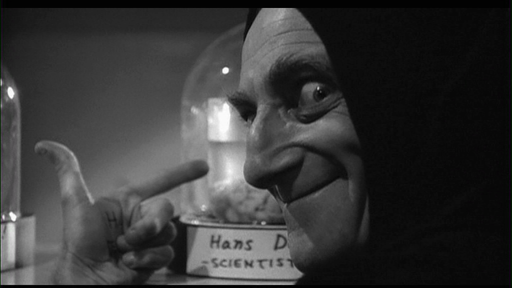 Frankenstein_Junior_03_-_Igor_cervello_Hans_Delbruck